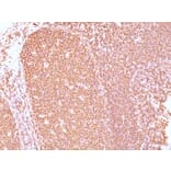 Immunohistochemistry - Anti-CD45RB Antibody [PD7/26] (A249807) - Antibodies.com