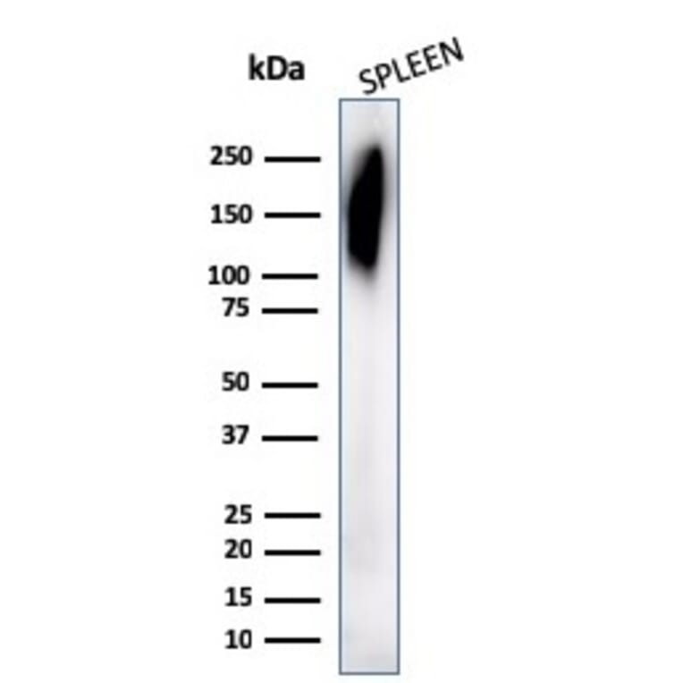 Western Blot - Anti-CD45RB Antibody [PD7/26] (A249807) - Antibodies.com