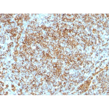 Immunohistochemistry - Anti-CD45RB Antibody [SPM569] (A249807) - Antibodies.com