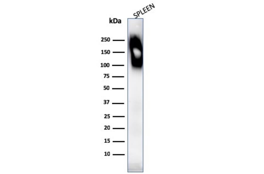 Western Blot - Anti-CD45RB Antibody [SPM569] (A249808) - Antibodies.com