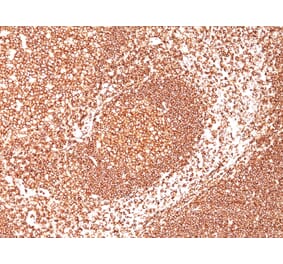 Immunohistochemistry - Anti-CD45 Antibody [2B11 + PD7/26] (A249809) - Antibodies.com