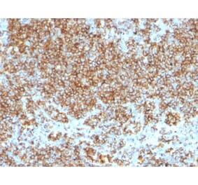 Immunohistochemistry - Anti-CD45 Antibody [SPM569 + SPM570] (A249809) - Antibodies.com