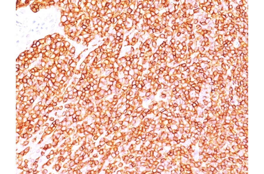 Immunohistochemistry - Anti-CD45RB Antibody [BRA-11] (A249811) - Antibodies.com