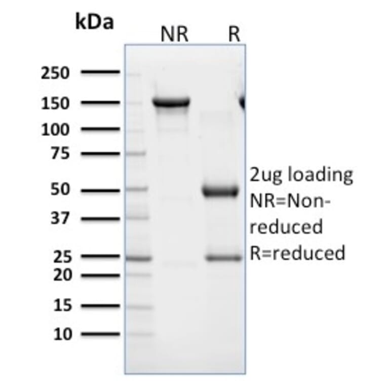 SDS-PAGE - Anti-CD45RB Antibody [BRA-11] (A249811) - Antibodies.com