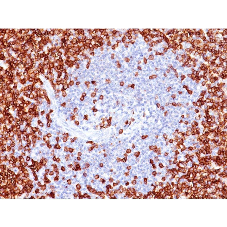 Immunohistochemistry - Anti-CD45RO Antibody [T200/797] (A249812) - Antibodies.com