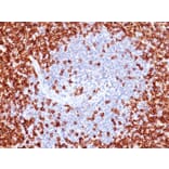 Immunohistochemistry - Anti-CD45RO Antibody [T200/797] (A249812) - Antibodies.com