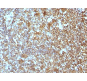 Immunohistochemistry - Anti-CD45RA Antibody [SPM504] (A249813) - Antibodies.com