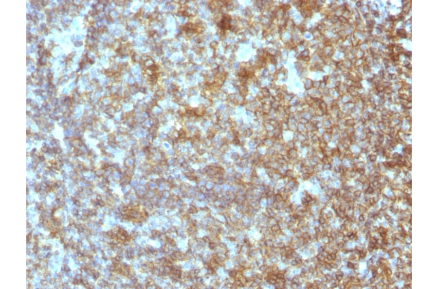 Immunohistochemistry - Anti-CD45RA Antibody [SPM504] (A249813) - Antibodies.com