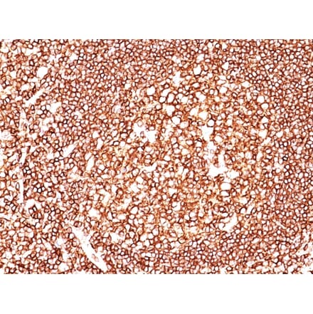 Immunohistochemistry - Anti-CD45 Antibody [135-4C5] (A249815) - Antibodies.com