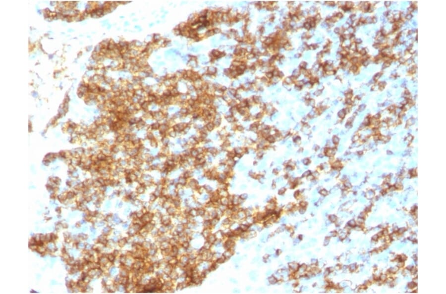 Immunohistochemistry - Anti-CD45RB Antibody [PTPRC/1783R] (A249816) - Antibodies.com