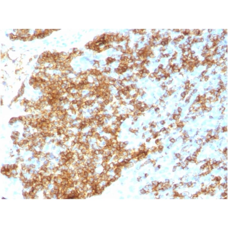 Immunohistochemistry - Anti-CD45RB Antibody [PTPRC/1783R] (A249816) - Antibodies.com