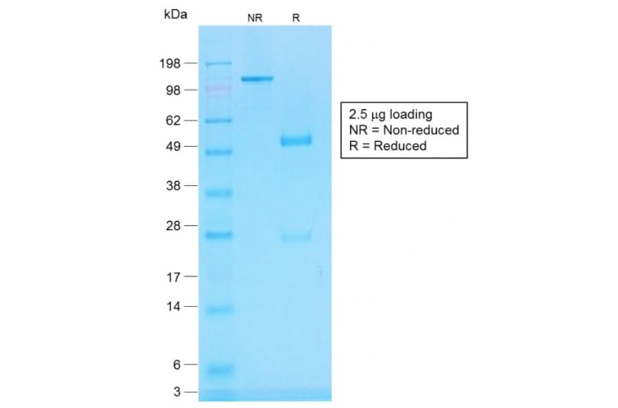 SDS-PAGE - Anti-CD45RB Antibody [PTPRC/1783R] (A249816) - Antibodies.com