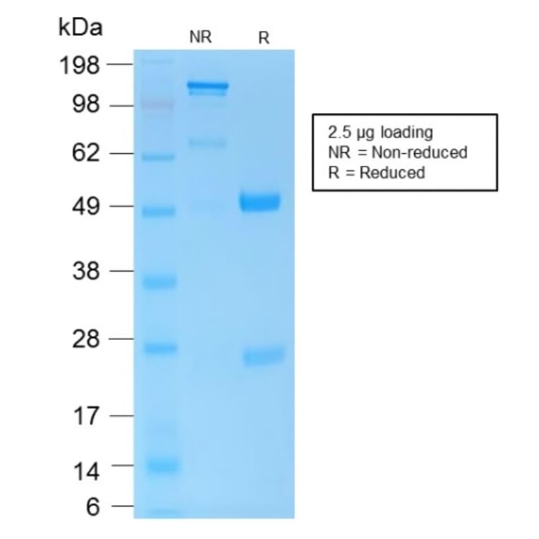 SDS-PAGE - Anti-CD45 Antibody [PTPRC/1975R] (A249817) - Antibodies.com