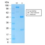 SDS-PAGE - Anti-CD45 Antibody [PTPRC/1975R] (A249817) - Antibodies.com