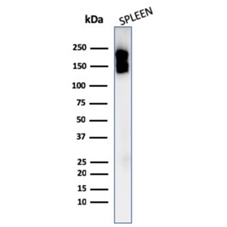 Western Blot - Anti-CD45 Antibody [PTPRC/1975R] (A249817) - Antibodies.com