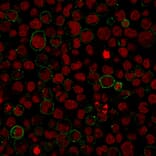 Immunocytochemistry - Anti-CD45 Antibody [PTPRC/1975R] (A249817) - Antibodies.com