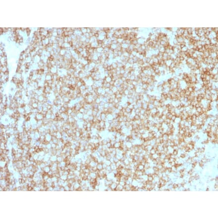 Immunohistochemistry - Anti-CD45 Antibody [PTPRC/1783R + PTPRC/1975R] (A249817) - Antibodies.com