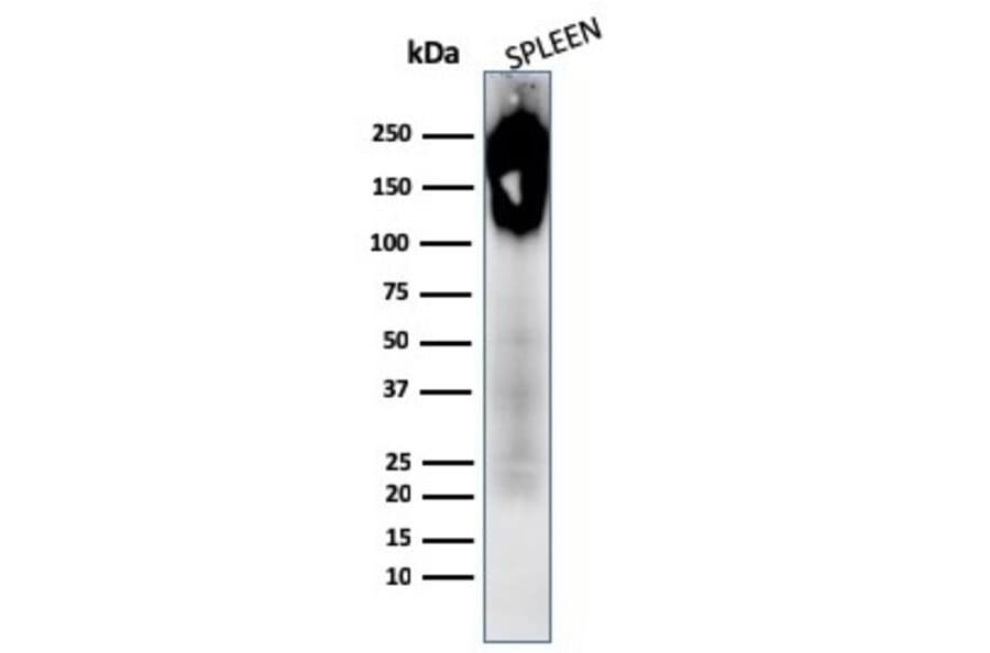 Western Blot - Anti-CD45 Antibody [PTPRC/1783R + PTPRC/1975R] (A249818) - Antibodies.com