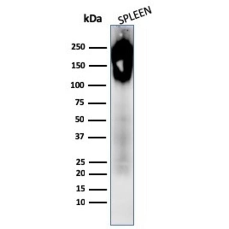 Western Blot - Anti-CD45 Antibody [PTPRC/1783R + PTPRC/1975R] (A249818) - Antibodies.com