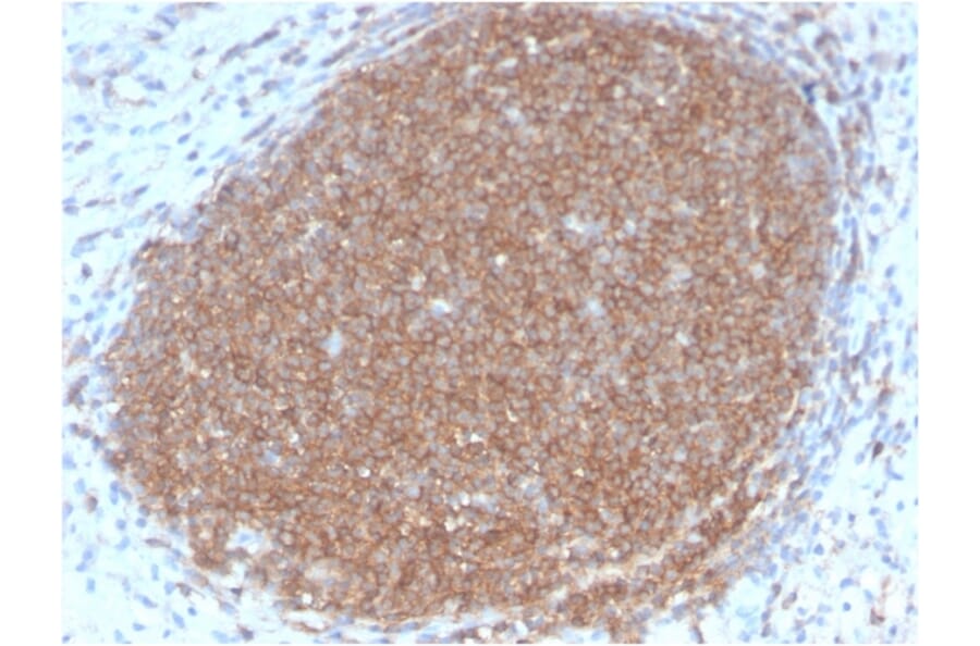 Immunohistochemistry - Anti-CD45RB Antibody [PTPRC/2877R] (A249819) - Antibodies.com