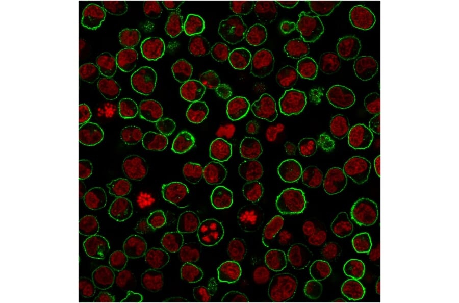 IF - Recombinant Anti-CD45RB Antibody [PTPRC/2877R] (A249819)