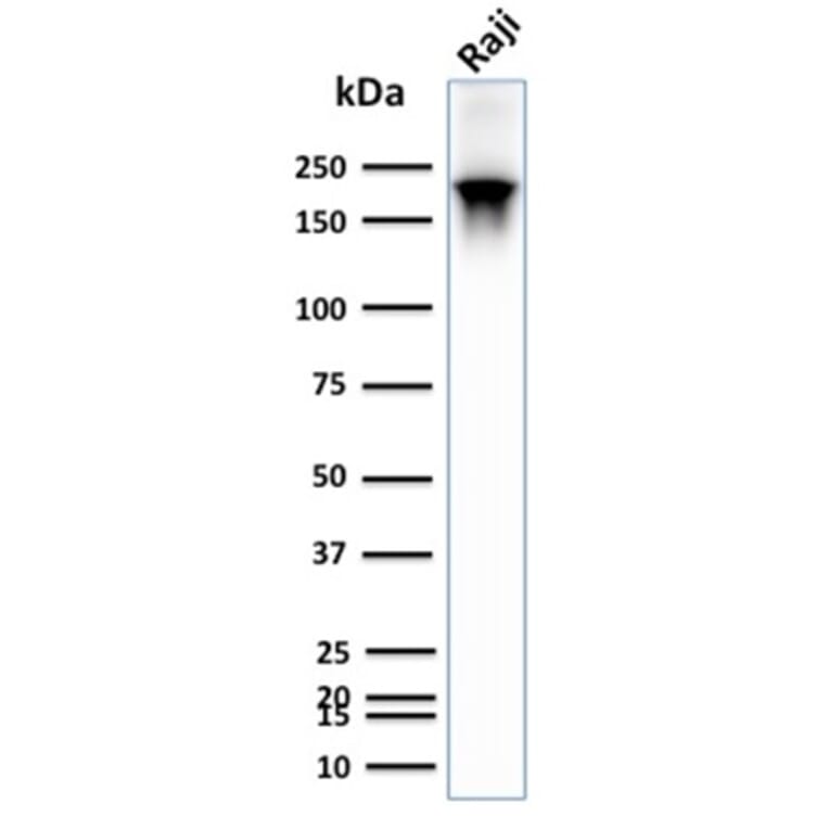 Western Blot - Anti-CD45RB Antibody [PTPRC/2877R] (A249819) - Antibodies.com