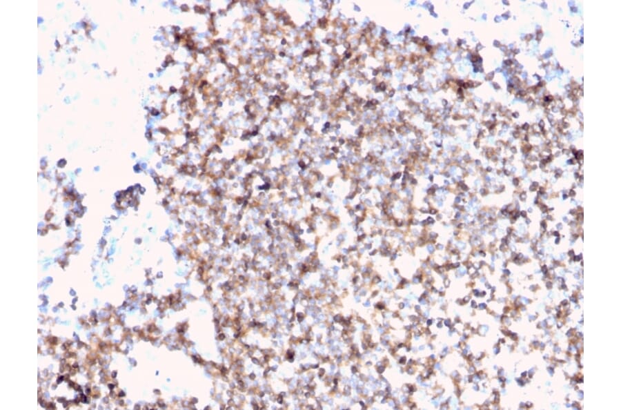 Immunohistochemistry - Anti-CD45 Antibody [PTPRC/3881R] (A249819) - Antibodies.com