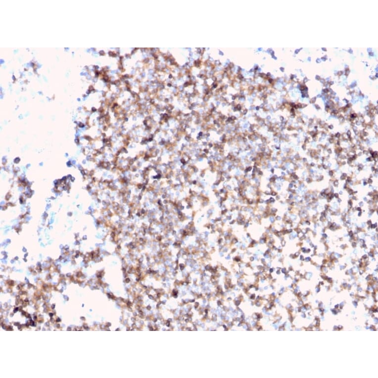 Immunohistochemistry - Anti-CD45 Antibody [PTPRC/3881R] (A249819) - Antibodies.com