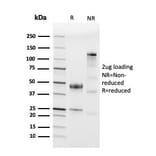 SDS-PAGE - Anti-CD45 Antibody [PTPRC/3881R] (A249820) - Antibodies.com