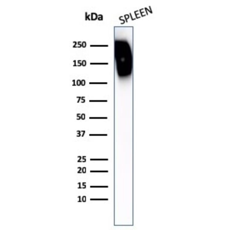 Western Blot - Anti-CD45RB Antibody (A249821) - Antibodies.com
