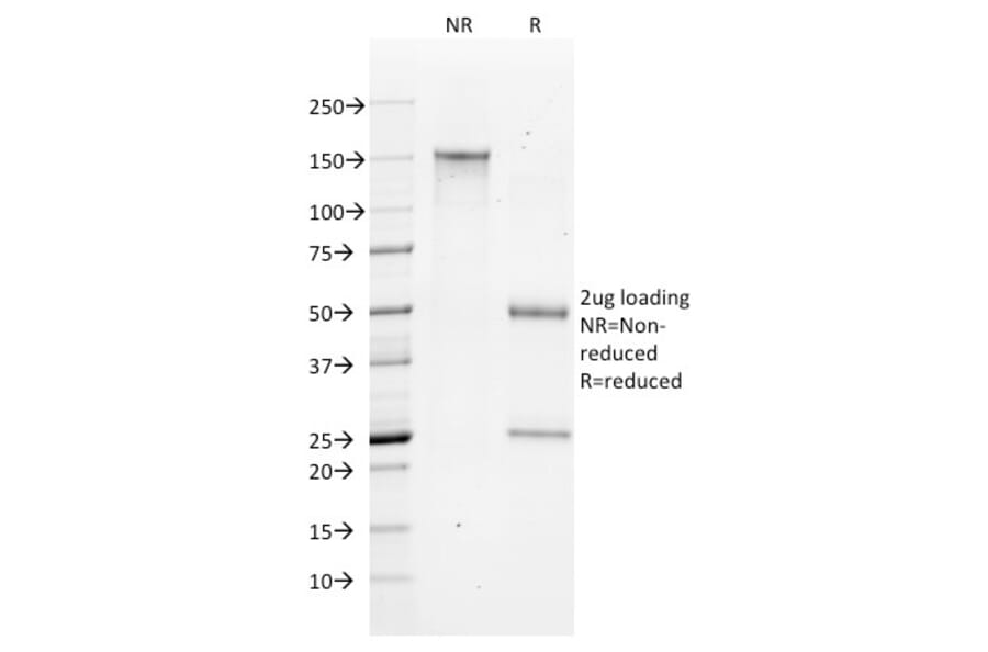 SDS-PAGE - Anti-Bax Antibody [2D2] (A249822) - Antibodies.com