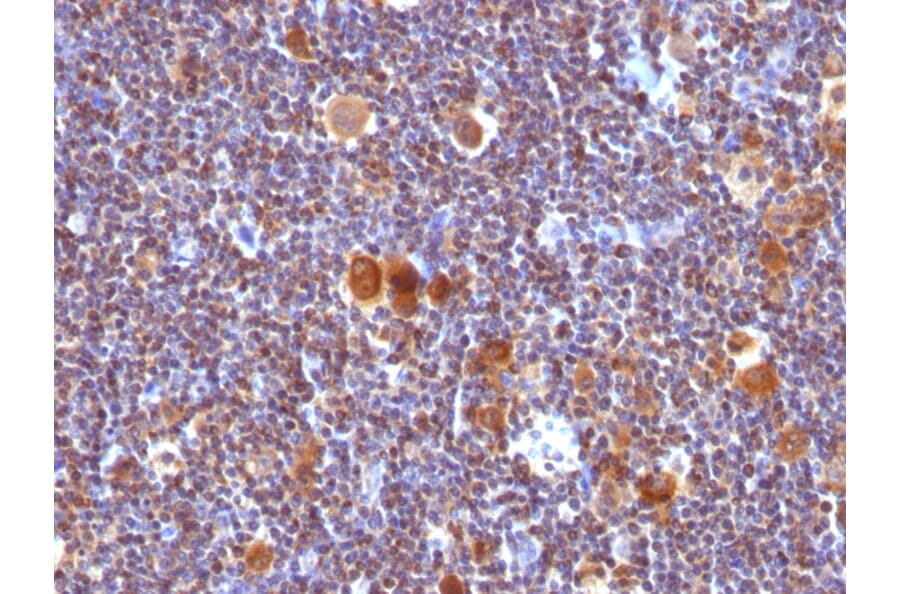 Immunohistochemistry - Anti-Bax Antibody [SPM336] (A249823) - Antibodies.com