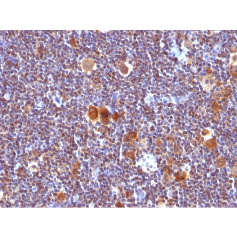 Immunohistochemistry - Anti-Bax Antibody [SPM336] (A249823) - Antibodies.com