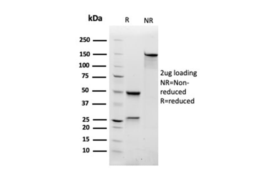 SDS-PAGE - Anti-RAC1 Antibody [CPTC-RAC1-1] (A249827) - Antibodies.com
