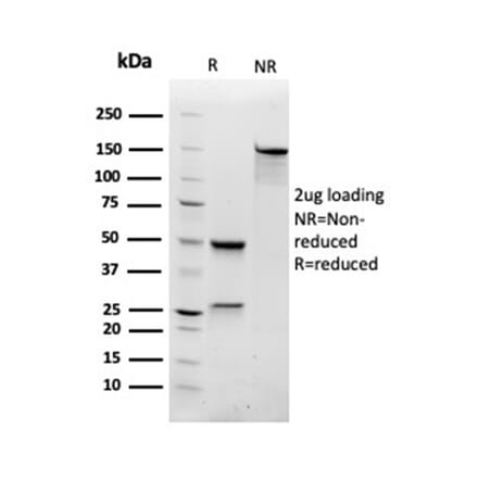 SDS-PAGE - Anti-RAC1 Antibody [CPTC-RAC1-1] (A249827) - Antibodies.com