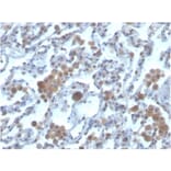 Immunohistochemistry - Anti-RAC1 Antibody [CPTC-RAC1-1] (A249827) - Antibodies.com