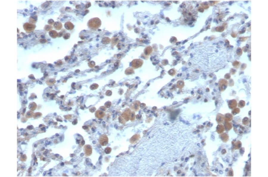 Immunohistochemistry - Anti-RAC1 Antibody [CPTC-RAC1-1] (A249827) - Antibodies.com