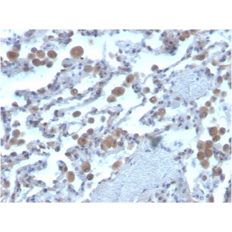 Immunohistochemistry - Anti-RAC1 Antibody [CPTC-RAC1-1] (A249827) - Antibodies.com