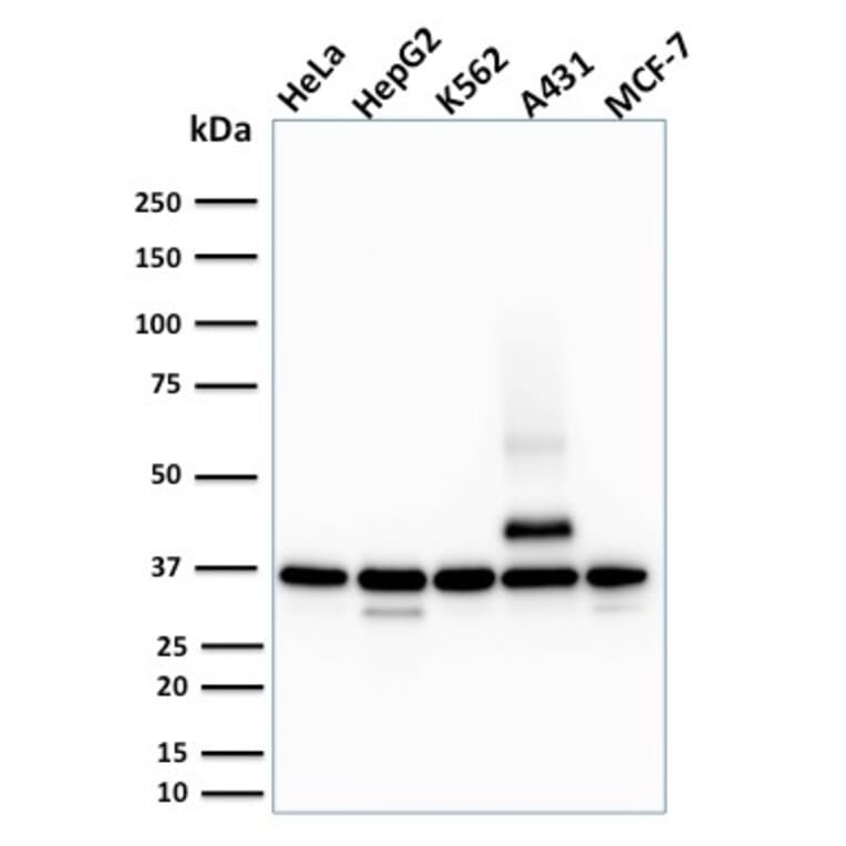 Western Blot - Anti-RAD51 Antibody [RAD51/2701] (A249828) - Antibodies.com