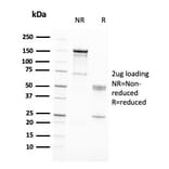 SDS-PAGE - Anti-RAD51 Antibody [RAD51/2701] (A249828) - Antibodies.com