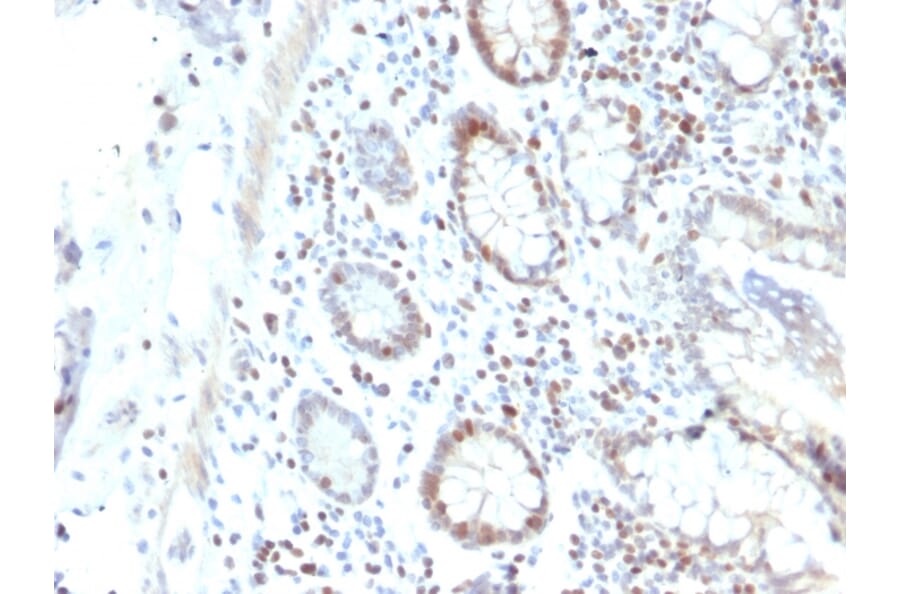Immunohistochemistry - Anti-RAD51 Antibody [RAD51/2702] (A249829) - Antibodies.com