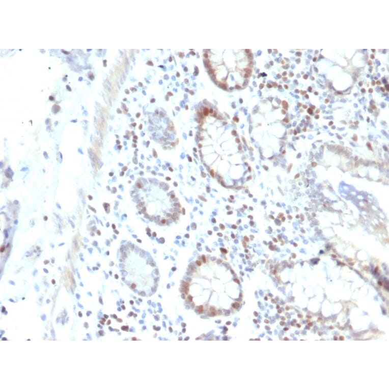 Immunohistochemistry - Anti-RAD51 Antibody [RAD51/2702] (A249829) - Antibodies.com