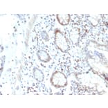 Immunohistochemistry - Anti-RAD51 Antibody [RAD51/2702] (A249829) - Antibodies.com