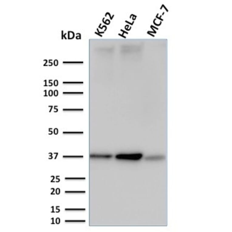 Western Blot - Anti-RAD51 Antibody [RAD51/2753] (A249830) - Antibodies.com