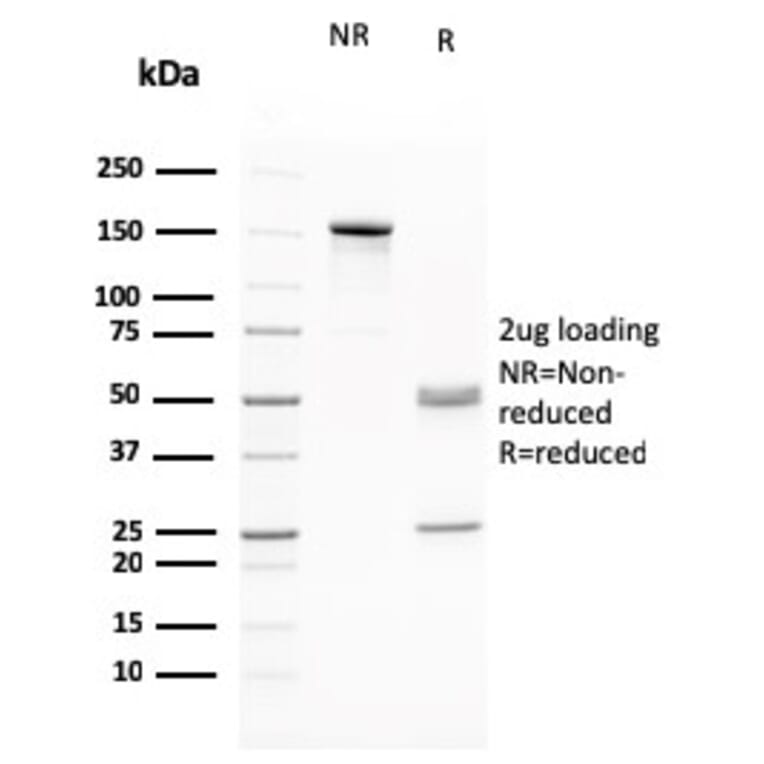 SDS-PAGE - Anti-RAD51 Antibody [RAD51/2765] (A249831) - Antibodies.com