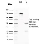 SDS-PAGE - Anti-RAD51 Antibody [RAD51/2765] (A249831) - Antibodies.com