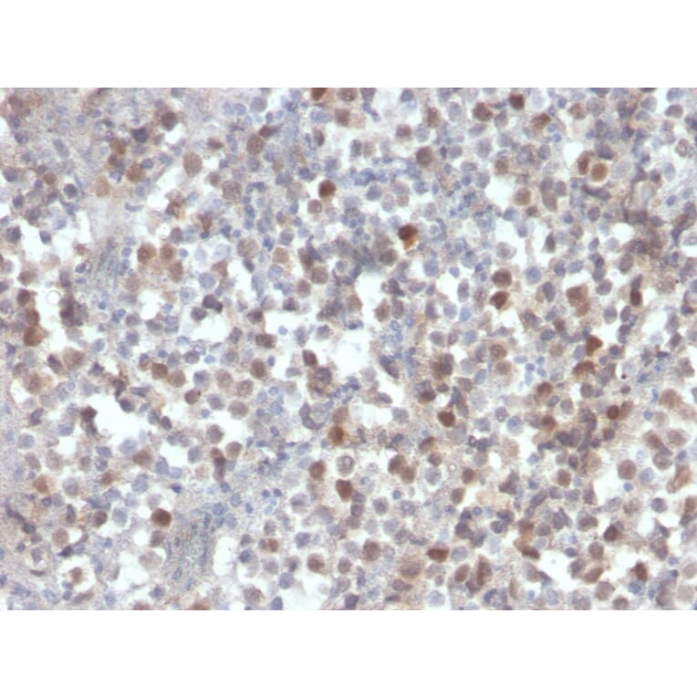 Immunohistochemistry - Anti-RAD51 Antibody [RAD51/2856] (A249832) - Antibodies.com