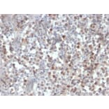 Immunohistochemistry - Anti-RAD51 Antibody [RAD51/2856] (A249832) - Antibodies.com