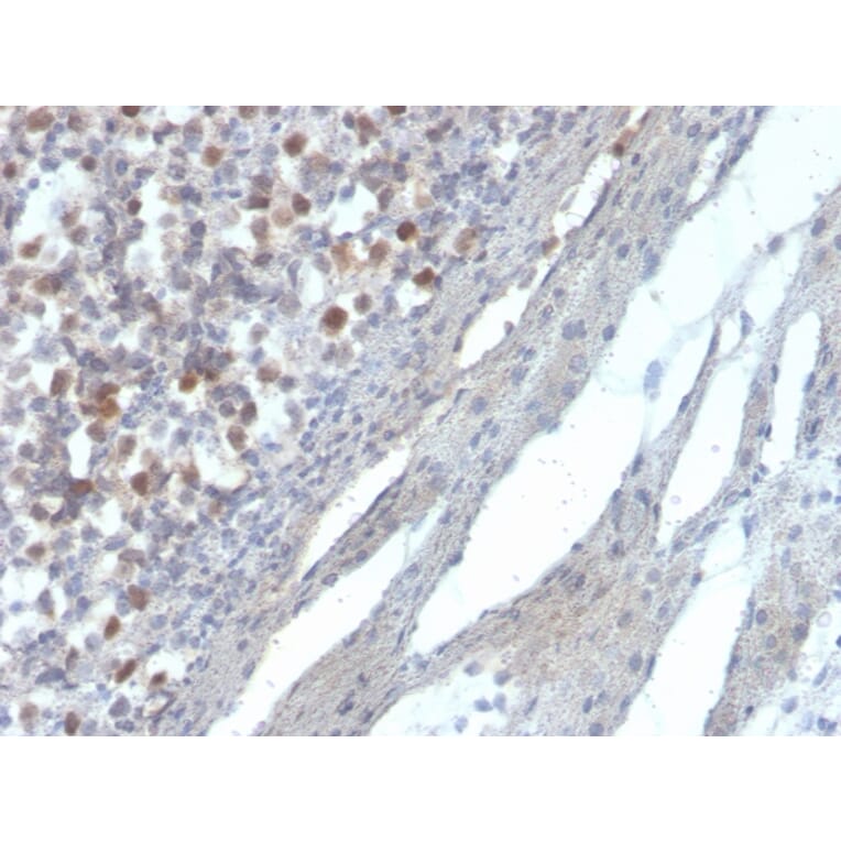 Immunohistochemistry - Anti-RAD51 Antibody [RAD51/2856] (A249832) - Antibodies.com