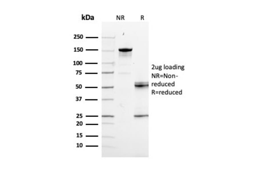 SDS-PAGE - Anti-RAD51 Antibody [RAD51/2856] (A249832) - Antibodies.com